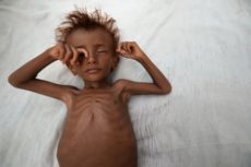A photograph from September 2016 shows a malnourished boy laying on a bed outside his family's hut in Hodaida, Yemen [Abduljabbar Zeyad/Reuters]